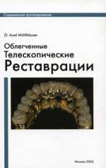 Мюльхойзер А. (Mühlhäuser) - Облегченные телескопические реставрации