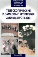 Лебеденко, Перегудов, Глебова - Телескопические и замковые крепления зубных протезов