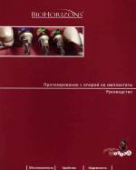 Протезирование с опорой на имплантаты. Руководство