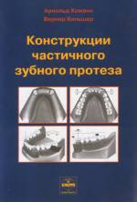 Хоманн, Хильшер - Конструкции частичного зубного протеза
