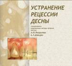 Февралева, Давидян - Устранение рецессии десны (планирование, современные методы лечения, прогноз)